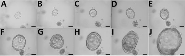 Growth of 3-dimensional human intestinal enteroid (HIE) embedded in Matrigel in the presence of complete media with growth factors containing Wnt3a, R-spondin, and Noggin as part of study of human norovirus replication in HIEs. Microscopy images show the growth of a representative undifferentiated HIE: A) day 1; B) day 2; C) day 3; D) day 4; E) day 5; F) day 6; G) day 7; H) day 8; I) day 9; J) day 10. Scale bars indicate 100 μm. 