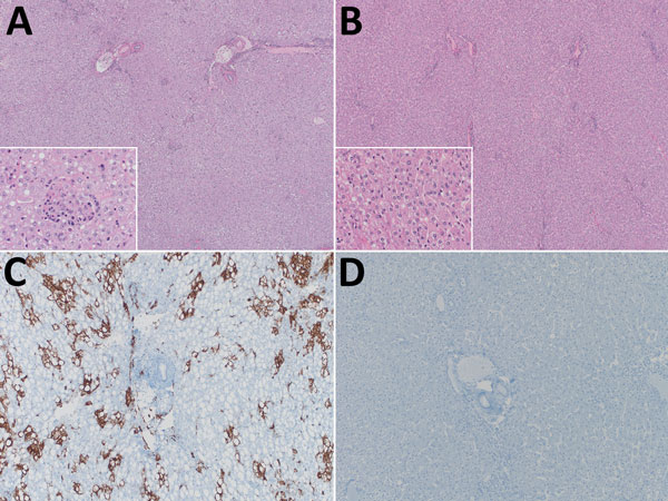 Histologic and in situ hybridization analyses of livers from cynomolgus macaques infected with Lassa virus (LASV) (1 × 104 50% tissue culture infective dose [TCID50]) and treated 1 time daily with favipiravir (treated) or vehicle only (control). A–B) Histologic analyses. A) Control, showing multifocal neutrophilic infiltrates with hepatocyte necrosis and degeneration (original magnification ×40). Inset shows hepatocyte necrosis (original magnification ×400). B) Treated, showing essentially healt
