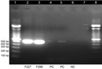Thumbnail of Gel electrophoresis of dengue virus–specific RT-PCR products in study of dengue virus among 166 children with suspected malaria, Accra, Ghana, October 2016–July 2017. We completed a conventional RT-PCR assay by using dengue-specific primers from Lanciotti et al. (15) to confirm the results of the TaqMan array card assays. The amplification products (expected size 511 bp) were electrophoresed on 2% agarose gel, stained with ethidium bromide, and viewed under ultraviolet light. Lane 1