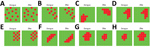 Thumbnail of Schematic representation of the spatial patterns of dengue and Zika risk revealed by the joint models of relative risk models, Colombia, 2015–2016. A) Model 1; B) model 2; C) model 3; D) model 4; E) model 5; F) model 6; G) model 7; H) model 8. For a set of small areas, high-risk areas are represented in red and low-risk areas are represented in green, depicting several patterns that could or could not be shared for both diseases in the same geographic area.