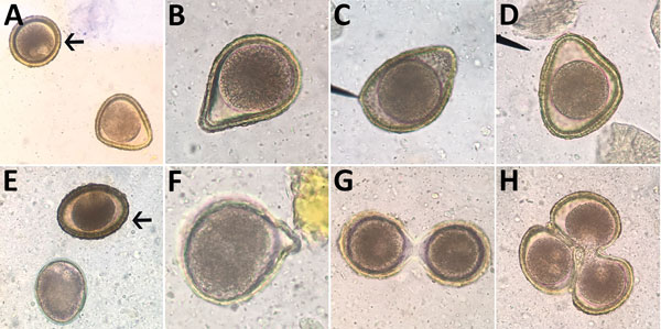 Abnormalities of Baylisascaris procyonis eggs shed by experimentally inoculated dogs and raccoons, visualized on fecal flotation. A) Triangular egg. B) Pear-shaped egg. C) Almond-shaped egg. D) Triangular egg with indented edge. E) “Immature” egg with underdeveloped morula and no cortex or proteinaceous coat. F) Budded egg. G) Twin conjoined eggs with separate morulae and vitelline membranes. H) Triplet conjoined eggs with distinct morulae; vitelline membrane might be shared between 2 eggs. Arro