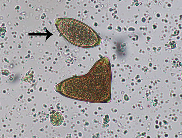 Conjoined Trichuris vulpis eggs from a domestic dog, visualized on fecal flotation. Arrow indicates a morphologically normal egg. Original magnification ×400. Photograph by Danielle E. Preston and courtesy of Mani Lejeune, both of the Cornell University College of Veterinary Medicine (Ithaca, NY, USA). 