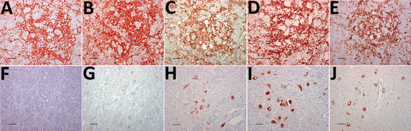 Thumbnail of Immunohistochemical detection of disease-associated prion protein in brain sections at the level of the obex in cervids with chronic wasting disease, Norway. A–E) Reindeer; F–J) moose. mAbs used were 12B2 (A, F), 9A2 (B, G), L42 (C, H), SAF 84 (D, I), and F99/97.6 (E, J). Staining obtained in the reindeer tissues are similar regardless of mAbs used (A–E). Conversely, for moose tissues, the staining was primarily observed intraneuronally with L42, SAF84, and F99/97.6 (H–J) but was no