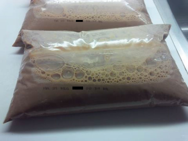 Bags of pasteurized chocolate milk as sold in Canada, with outer bag containing brand information removed. A bag of milk similar to these, found at the home of 1 case-patient during investigation of an outbreak of Listeria monocytogenes infection associated with pasteurized chocolate milk in Ontario, Canada, was found to be contaminated with the same strain obtained from infected patients.