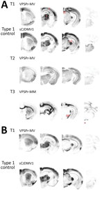 Thumbnail of Representative paraffin-embedded tissue (PET) blots of protease-resistant, disease-related prion protein (resPrPD) distribution in phenotypes T1–T3 and controls. A) For T1, PrPD predominated in cerebral cortex (C), thalamus (T), superior colliculus (SC), lateral geniculate nucleus (LG), and substantia nigra (SN). A similar PrPD distribution was observed with transmission of sCJDMV1 used as type control. T2 showed a more uniform distribution in cerebral cortex and subcortical nuclei 
