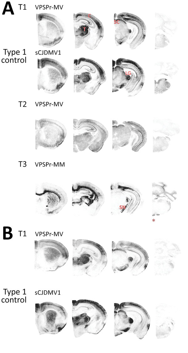 Representative paraffin-embedded tissue (PET) blots of protease-resistant, disease-related prion protein (resPrPD) distribution in phenotypes T1–T3 and controls. A) For T1, PrPD predominated in cerebral cortex (C), thalamus (T), superior colliculus (SC), lateral geniculate nucleus (LG), and substantia nigra (SN). A similar PrPD distribution was observed with transmission of sCJDMV1 used as type control. T2 showed a more uniform distribution in cerebral cortex and subcortical nuclei of an apparen