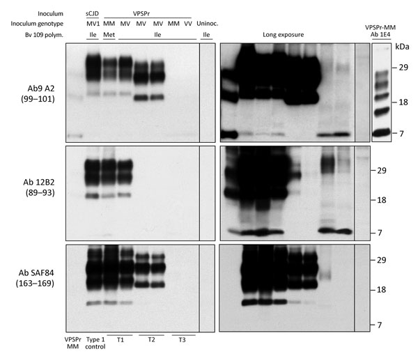 Immunoblot characteristics of protease-resistant, disease-related prion protein (resPrPD) distribution in phenotypes T1–T3 and controls. Regular and long exposures revealed the overall similarity of the 3-band profiles in T1 and T2, but resPrPD profile, including glycoform representation, differed in the 2 phenotypes with all 3 monoclonal antibodies (Ab) used. T1 included a 7-kDa band, not detected in T2, similar to mobility and Ab immunoreactivity of the T3 7-kDa fragment. The T1 profile matche