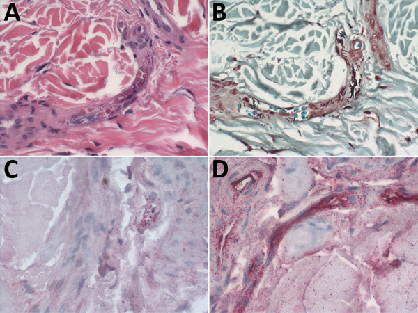 Photomicrographs showing hematoxylin and eosin stain and immunohistochemical findings, using assays targeting the cell wall and capsule of Bacillus anthracis, in ear-punch biopsy specimens from a hippopotamus infected with B. anthracis, Bwabwata National Park, Namibia, 2017. A) Hematoxylin and eosin stain showing large bacilli evident in vessel lumen. Original magnification × 40. B) Gram stain showing gram-variable rods evident in vessels. Original magnification × 40. C) Immunohistochemical stai