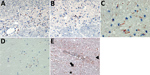 Thumbnail of Induction of apoptosis in brain cells through association with granzyme B+/CD8+ cells, formation of cleaved caspase 3 and p53 up-regulation. A, B) Granzyme B+ cells in association with neurons and astrocytes during variegated squirrel bornavirus 1 infection. Immunoperoxidase stain with hematoxylin counterstain; original magnification ×400. C) Demonstration of brain cell apoptosis by shrinkage and positivity for cleaved caspase 3 (red) in close contact with CD8+ T cells (blue). Immun