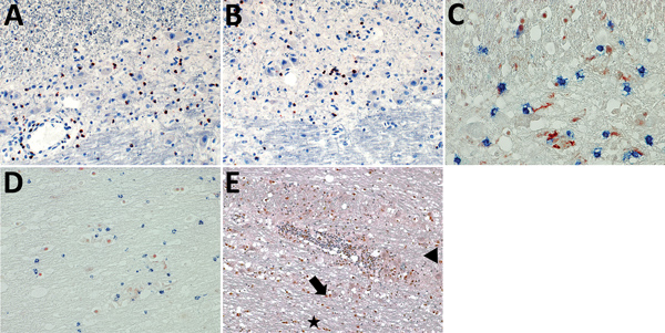 Induction of apoptosis in brain cells through association with granzyme B+/CD8+ cells, formation of cleaved caspase 3 and p53 up-regulation. A, B) Granzyme B+ cells in association with neurons and astrocytes during variegated squirrel bornavirus 1 infection. Immunoperoxidase stain with hematoxylin counterstain; original magnification ×400. C) Demonstration of brain cell apoptosis by shrinkage and positivity for cleaved caspase 3 (red) in close contact with CD8+ T cells (blue). Immunoperoxidase a