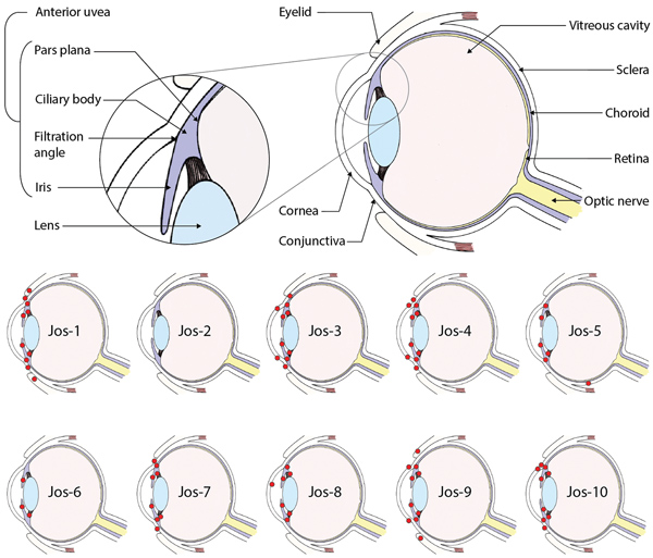 Lassa virus (LASV) localization in guinea pigs that died of or survived infection with LASV-Josiah in study of LASV targeting of anterior uvea and endothelium of cornea and conjunctiva in eye. Primary diagram at top shows major structures of the eye; smaller diagrams detail the general regions in which LASV antigen (red circles) was detected in the eye of each animal by immunohistochemical analysis. All animals were euthanized because of disease (14–23 days postinfection) except Jos-2, which did