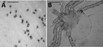 Thumbnail of Larvae of lone star ticks collected from New York and Massachusetts, USA, in 2018. A) Portion of lint roller tape with cluster of larval lone star ticks. Scale bar indicates 10 mm. B) Rounded idiosoma, 11 festoons (short dark arrow marks festoon 1; longer dark arrow, festoon 11); rounded edge of the basis capitulum (long light arrow), and palps longer than wide. Scale bar indicates 210 microns.