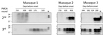 Thumbnail of Detection of m-vCJD prions by PMCA in macaques during early stages of disease. These prions were probably endogenously generated rather than present in the inoculum. The second and third rounds of the PMCA-positive preclinical buffy coat samples were digested with 50 μg/mL of proteinase K and analyzed by Western blot. Samples were arranged from the earliest preclinical on the left to the closest to disease onset on the right. N refers to transgenic mouse normal BH without proteinase