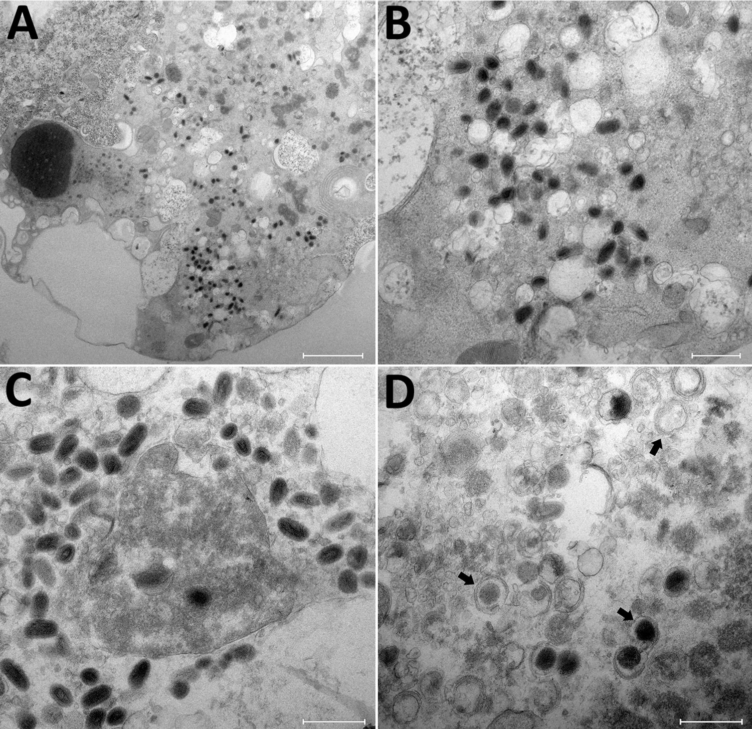 Transmission electron microscopy of OAT3.T cells infected with orf virus IHUMI-1 from a 65-year-old woman in France. A) Ultrathin section of an OAT3.Ts cell at 24 h postinfection harboring orf virus strain IHUMI-1 undergoing its replicative cycle where dense inclusion bodies could be clearly seen in the cell cytoplasm. B, C) Higher magnifications of infected cells showing typical enveloped virions. D) Ultrathin sections of an OAT3.Ts cell showing enveloped particles (arrows). Scale bars indicate