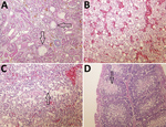 Thumbnail of Histologic appearance of lesions in tissues from chickens experimentally infected with a novel orthobunyavirus (Kedah fatal kidney syndrome virus) isolated from broiler chickens with severe kidney disease, Malaysia, 2014–2017. A) Kidney, showing urate deposits in the dilated Bowman’s capsule (arrows) and degeneration and dilatation of proximal convoluted tubules. Trichcrome stain; original magnification ×200. B) Liver, showing vacuolar degeneration of hepatocytes and disorganization