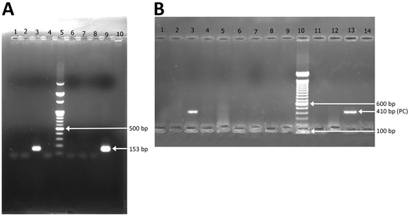 Agarose gel (2%) electrophoresis of nested PCR products of amplified Plasmodium knowlesi DNA sequences taken from mosquito samples (10 mosquitoes per pool) from Andaman and Nicobar Islands. A) Analysis of PCR products amplified with Pmk8 and Pmk9 primers. Lanes 1–4, pools of Anopheles sundaicus mosquitoes; lane 5, size marker DNA (100-bp DNA ladder); lanes 6 and 7, An. maculatus mosquito pools; lane 8, An. barbirostris mosquito pool (2 mosquitoes); lane 9, positive control; lane 10, negative con