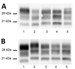Thumbnail of Atypical BSE transmission into sheep PrP transgenic mice in a study of atypical BSE transmission using isolates from different countries in Europe and transgenic mouse models overexpressing human normal brain prion protein. A) Brain PrPres profile of L-BSE prions (lane 2) changed once passaged into TgVRQ (lane 3) and TgARQ (lane 5). L-BSE propagation into TgVRQ and TgARQ produced a PrPres profile with a molecular weight slightly higher than C-BSE (lane 1). L-BSE/TgVRQ transmission i