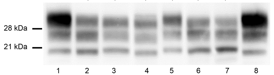 Bovine-PrP transgenic mice challenged with atypical BSEs transmitted into human-PrP transgenic mice before and after adaptation to sheep-PrP sequence in a study of atypical BSE transmission using isolates from different countries in Europe and transgenic mouse models overexpressing human normal brain prion protein. Brain PrPres in TgBo mice inoculated with different atypical BSE either before or after passage into the different transgenic lines. L-BSE biochemical profile (lane 2) changed once pa