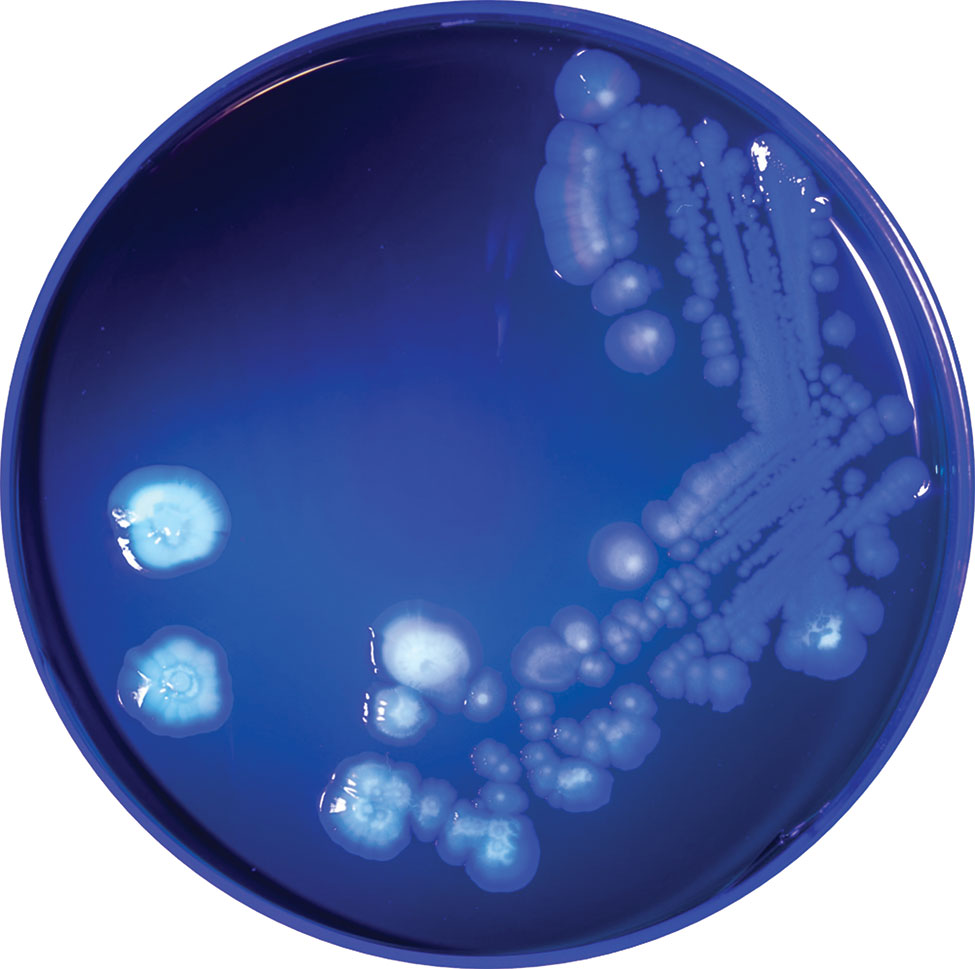 Pseudomonas poae colonies isolated from contaminated packed red blood cell unit, Peoria, Illinois, USA, 2017, fluorescing under ultraviolet light (λ = 395 nm).