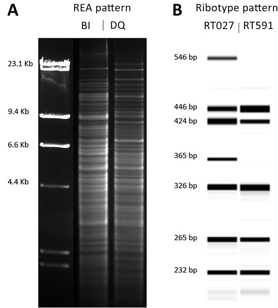Comparison of the molecular characteristics of Clostridioides difficile strain DQ/591 and the epidemic BI/027 strain in study of C. difficile at 2 US Veteran Affairs long-term care facilities and their affiliated acute care facilities. The HindIII REA (A) and PCR ribotype (B) banding patterns were distinct between REA strain DQ/RT591 and REA strain BI/RT027. Molecular weight markers (in kb) are shown adjacent to the REA gel pattern. An internal spiked LIZ 1200 standard was used for fragment leng