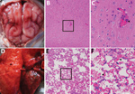 Thumbnail of Dissected brain and lung of a dead fox, collected in 2017 in Shandong Province, eastern China, and histopathologic examination of samples using hematoxylin and eosin staining. A) Brain, showing congestion in the meninx. B) Histologic view of meninx, showing mild neuronal degeneration and inflammatory cell infiltration in vessels. Original magnification ×100. Box indicates area enlarged in panel C. C) A higher magnification view (original magnification ×400) of lesions in panel B, sh
