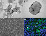 Thumbnail of Transmission electron microscopy and cell culture–based diagnosis of monkeypox in patient in Israel, 2018. Virus particles were detected in lesion samples as either virion aggregates (arrows) (A) or individual virions (B) with a typical brick shape. Infected Vero cells depicted typical cytopathic effect, exhibiting cell detachment and rounding. Scale bar in A indicates 0.2 μm; scale bar in B indicates 100 nm. C) Immunofluorescent staining of infected cells; original magnification ×1
