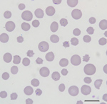 Thumbnail of Blood smear of an animal from a farm in Albemarle County, Virginia, USA, that were infected with Theileria orientalis Ikeda genotype. There is evidence of a regenerative response to anemia (anisocytosis and polychromasia) and intracellular piroplasms within erythrocytes. Scale bar indicates 10 µm.