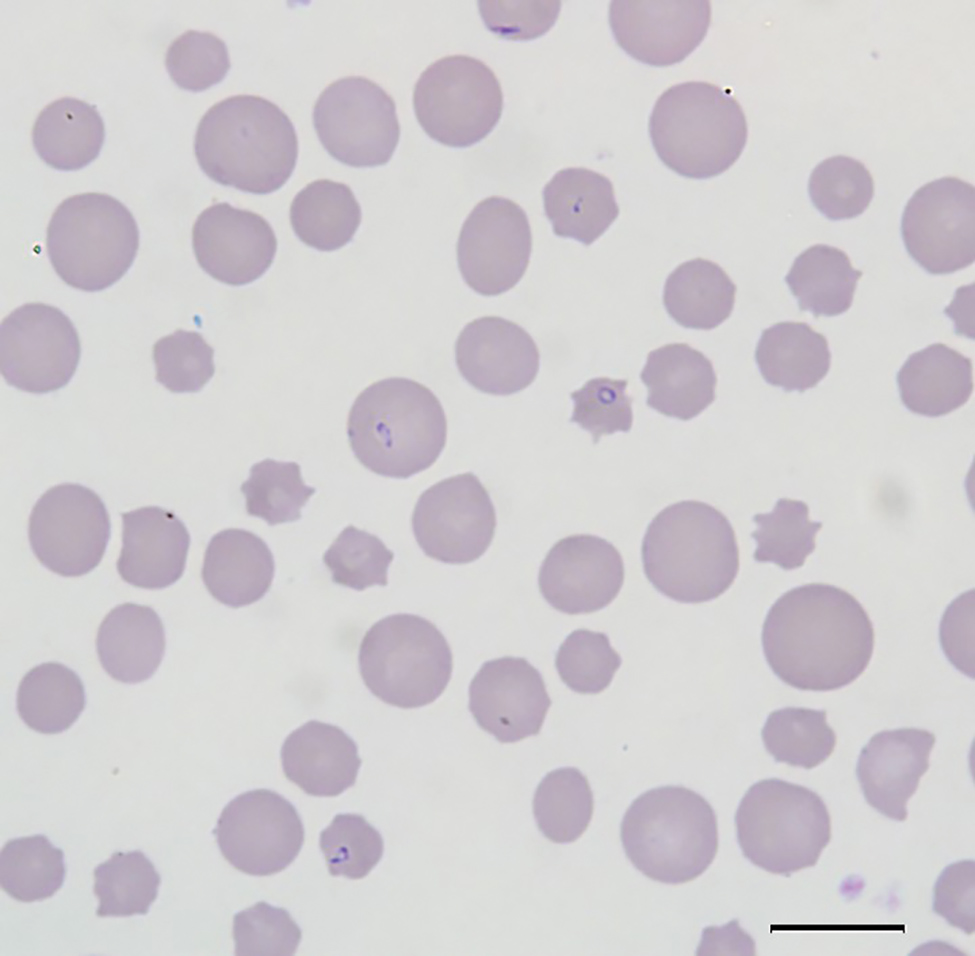 Blood smear of an animal from a farm in Albemarle County, Virginia, USA, that were infected with Theileria orientalis Ikeda genotype. There is evidence of a regenerative response to anemia (anisocytosis and polychromasia) and intracellular piroplasms within erythrocytes. Scale bar indicates 10 µm.