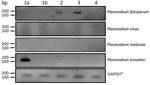 Thumbnail of Nested PCR of Plasmodium knowlesi DNA isolated from a patient in Poland with recent travel to Southeast Asia. Lane 1a, patient sample from day of admission; lane 1b, patient sample taken 11 days after implementing malarial treatment; lanes 2 and 3, samples taken from patients previously diagnosed with Plasmodium falciparum malaria; lane 4, sample from an afebrile person from Poland with no history of travel to tropical countries. *GAPDH, glyceraldehyde 3-phosphate dehydrogenase.