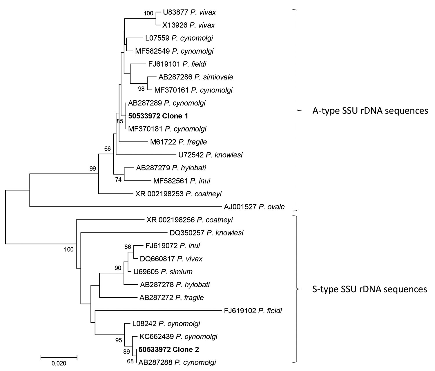 Phylogenetic analysis of the 2 consensus sequences (50533972 clone 1 and 50533972 clone 2) generated by the microbiome assay of blood from a traveler returning from Southeast Asia to Denmark. We used CD-HIT Suite (http://weizhong-lab.ucsd.edu/cdhit_suite/cgi-bin/index.cgi?cmd=cd-hit-est) to cluster sequences reflecting Plasmodium-specific DNA amplified and sequenced by our microbiome assay; we generated consensus sequences using an in-house sequence clustering software. We queried the 2 resultin