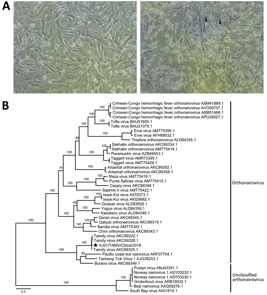 Identification of the Tamdy virus (TAMV) strain XJ01/TAMV/China/2018 from Hyalomma asiaticum ticks infesting Bactrian camels in Xinjiang, China, 2018, by cell culture and phylogenetic analysis. A) Light micrographs of cytopathic effects caused by TAMV infection at 11 days postinfection. Left, normal Vero cells as control; right, infected Vero cells with apparent cytopathic effects (black arrows). Original magnification ×100. B) Phylogenetic analysis of the RNA-dependent RNA polymerase protein se