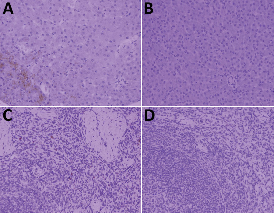 Brucella antigen in livers and spleens from Asian badgers infected with Brucella melitensis, northwestern China. A) Brucella antigen in liver of Asian badger no. 2; B) liver of an uninfected Asian badger; C) Brucella antigen in spleen of Asian badger no. 2; D) Spleen of badger without Brucella antigen. Diaminobenzidine staining; original magnification ×400.