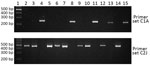Thumbnail of Specificity of PCR primer sets C1A and C2J for discriminating Plasmodium knowlesi infections of cluster 1 and Cluster 2 subpopulations, Kapit division, Sarawak state, Malaysian Borneo. Lane 1, DNA ladder; lane 2, KT025; lane 23, KT027; lane 24, KT029; lane 25, KT031; lane 26, KT042; lane 27, KT055; lane 28, KT057; lane 29, KT114; lane 210, BTG025; lane 211, BTG026; lane 212, BTG033; lane 213, BTG035; lane 214, BTG044; lane 215, BTG062. Primer sequences and amplification conditions a