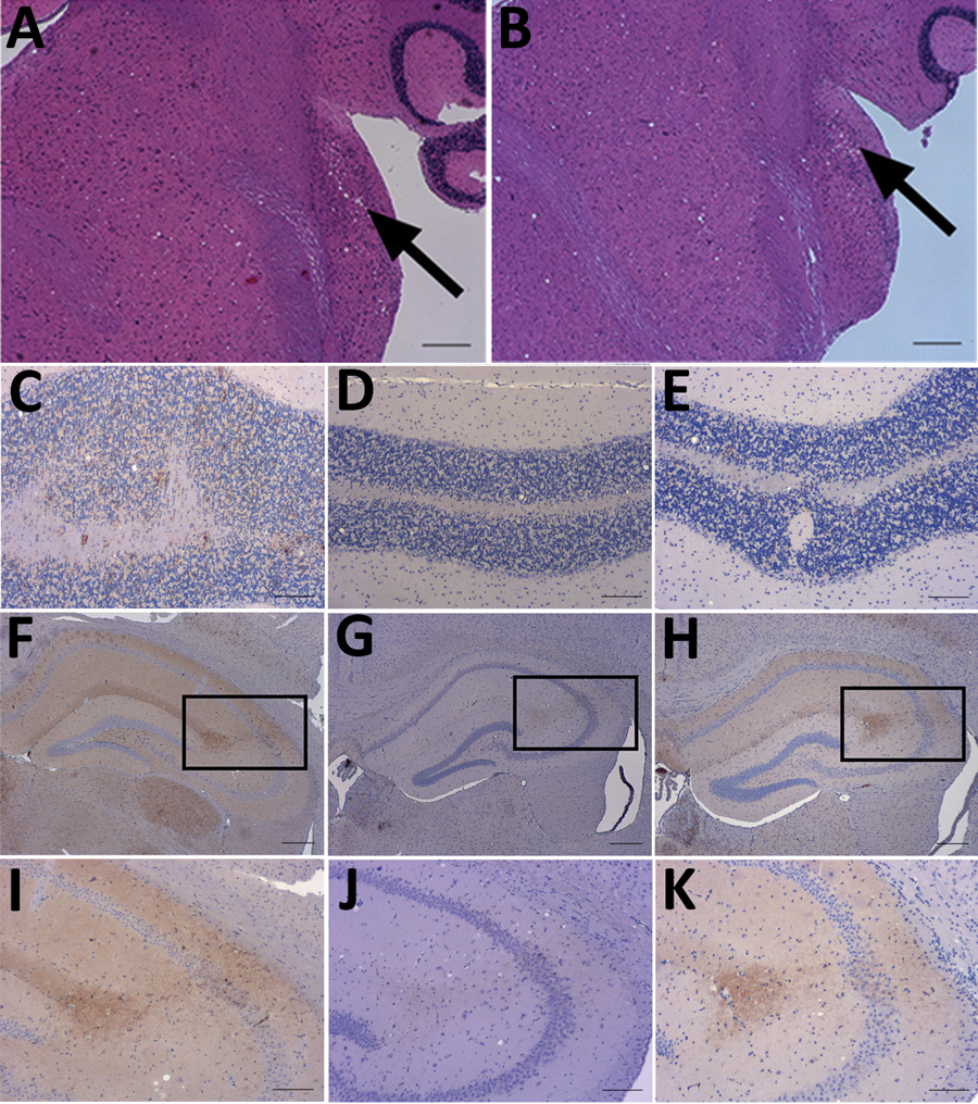 Neuropathology of RIII mice inoculated with material from a clinical case of vCJD in a prion protein gene codon 129MV individual, a typical 129MM case of vCJD, and BSE. A, B) Haemotoxylin and Eosin staining of transmissible spongiform encephalopathy vacuolation in the cochlear nucleus of mice inoculated with material from a clinical 129MV case (arrows). C–E) Abnormal PrP deposition in the cerebellum of mice inoculated with C) clinical 129MV case, D) typical 129MM case, and E) BSE. F–H) Abnormal 