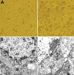 Thumbnail of Cytopathogenic effect and electron microscopic morphology of baby hamster kidney 21 (BHK-21) cells infected with phlebovirus (, China. A) Left panel shows morphology of BHK-21 cells before inoculation with strain SXWX1813-2; right panel shows morphology 3 days after inoculation. BHK-21 cells infected with SXWX1813-2 showed reduced adherence and a large number of rounded and exfoliated cells. B) Left panel shows the viral morphology of SXWX1813–2 on ultrathin slices; right panel show