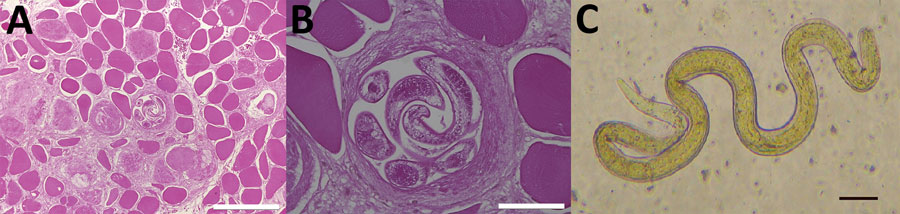 Trichinella larvae samples from patients in Cambodia. A) Transverse section of a muscle (bicep) biopsy specimen from patient 13 showing a nonencapsulated T. papuae stage 1 nematode larva in the center of the specimen (hematoxylin phloxine saffron stain; scale bar = 200 μm). B) Higher magnification view of the same biopsy specimen showing the coelomyarian muscle structure and stichosome of Trichinella larvae (scale bar = 50 μm). C) T. papuae stage 1 nematode larva after deparaffinization and arti