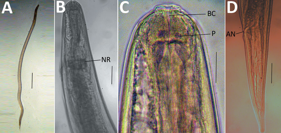 Microscopic images of Oxyspirura larvae collected from an infected patient, Vietnam. A) Whole body of Oxyspirura larvae; B, C) larvae anterior; D) larvae posterior. Scale bars indicate 100 μm in panel A, 50 μm in panels B–D. AN, anus; BC, buccal cavity; NR, nerve ring; P, papilla.
