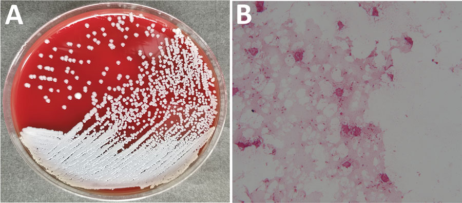 Burkholderia pseudomallei isolated from patient, China, 2019. A) Culture on sheep blood agar. B) Gram-stained smear. Original magnification ×1,000.