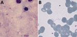 Thumbnail of Giemsa-stained thick (A) and thin (B) blood films, demonstrating extracellular spirochetes. Original magnifications ×1,000.