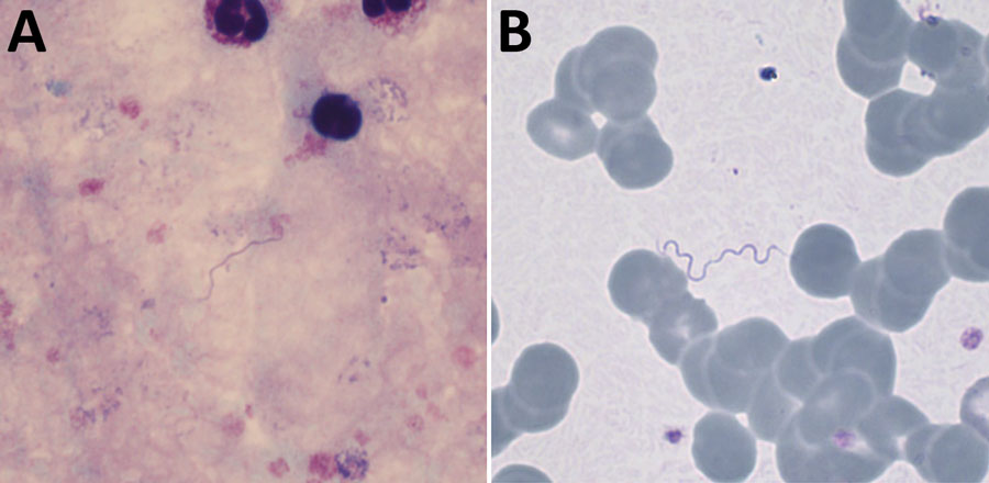 Giemsa-stained thick (A) and thin (B) blood films, demonstrating extracellular spirochetes. Original magnifications ×1,000.