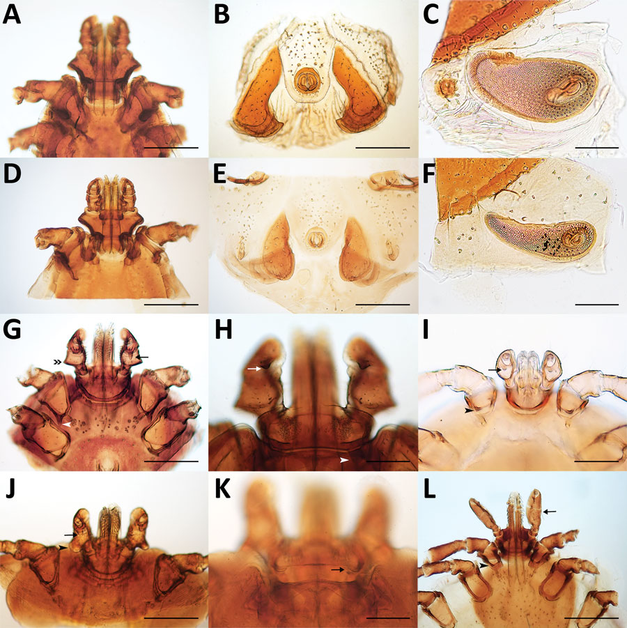 Morphologic characteristics of ticks collected from dogs and cats in study of ectoparasites and vectorborne zoonotic pathogens of dogs and cats in Asia, 2017–2018. A–C) Male Rhipicephalus haemaphysaloides tick with hexagonal basis capitulum (A); typical sickle-shape adanal plates (B); and spiracular plate with comma shape, broad throughout its length (C). D–F) Male R. sanguineus tick with hexagonal basis capitulum (D); triangular adanal plates (E); and comma-shaped spiracular plate, elongated th