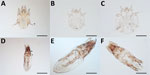Thumbnail of Mites collected from dogs and cats in study of ectoparasites and vectorborne zoonotic pathogens of dogs and cats in Asia, 2017–2018. A) Otodectes cynotis female mite with greatly reduced last pair of legs (arrow); the third pair of legs terminates in 2 long and whip-like setae (double arrowhead). B) Sarcoptes scabiei male mite with strong and spine-like dorsal setae (arrow). C) Notoedres cati mite with narrow and not spine-like setae. D) Female Lynxacarus radovskyi cat fur mite with