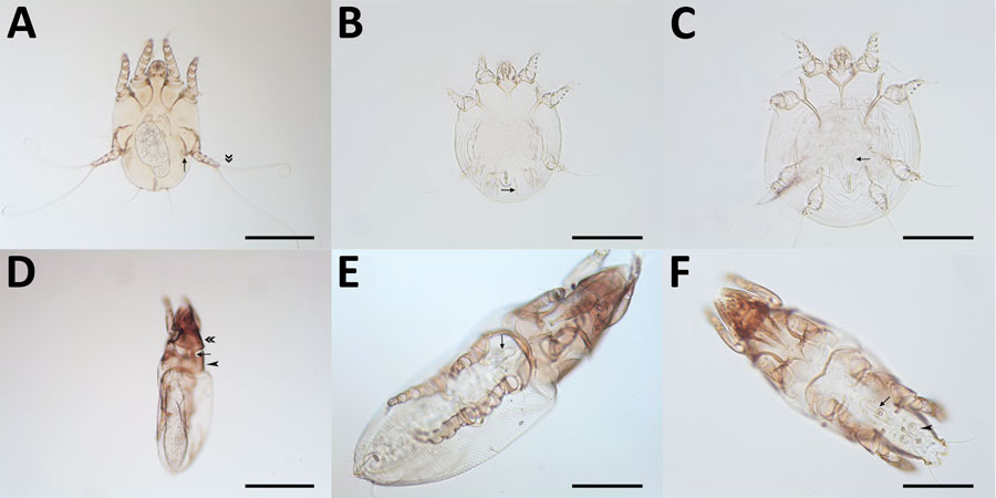 Mites collected from dogs and cats in study of ectoparasites and vectorborne zoonotic pathogens of dogs and cats in Asia, 2017–2018. A) Otodectes cynotis female mite with greatly reduced last pair of legs (arrow); the third pair of legs terminates in 2 long and whip-like setae (double arrowhead). B) Sarcoptes scabiei male mite with strong and spine-like dorsal setae (arrow). C) Notoedres cati mite with narrow and not spine-like setae. D) Female Lynxacarus radovskyi cat fur mite with cylindrical 