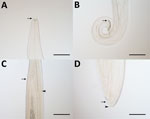 Thumbnail of Thelazia callipaeda eyeworms collected from animals in China in study of ectoparasites and vectorborne zoonotic pathogens of dogs and cats in Asia, 2017–2018. A) T. callipaeda male eyeworm with buccal capsule (arrow); B) posterior end of male eyeworm with short and crescent-shaped spicule (arrow); C) anterior portion of T. callipaeda female eyeworm with vulva (arrow) located posterior to the esophagus-intestinal junction (arrowhead); and D) posterior end of female eyeworm showing an