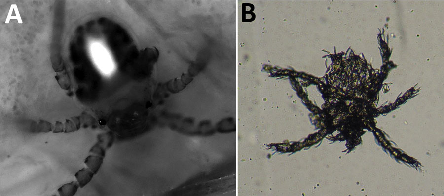 Images of trombiculid mites from infestation of a 48-year-old woman, Italy, April 2019. A) Fluorescence–advanced videodermatoscopy image shows oval body with 3 pairs of legs. Original magnification ×500. B) Optical microscope examination of 1 larva detected from a superficial skin scraping. Original magnification ×100.
