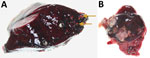 Thumbnail of Lung and tracheobronchial lymph nodes from a wild mule deer (Odocoileus hemionus) infected with Mycobacterium avium spp. hominissuis, Banff National Park, Alberta, Canada. A) Mineralized granulomas in the right caudal lung lobe (arrows). B) Pyogranulomatous lymphadenitis of a tracheobronchial lymph node. The lesions resemble those caused by infection with M. bovis.