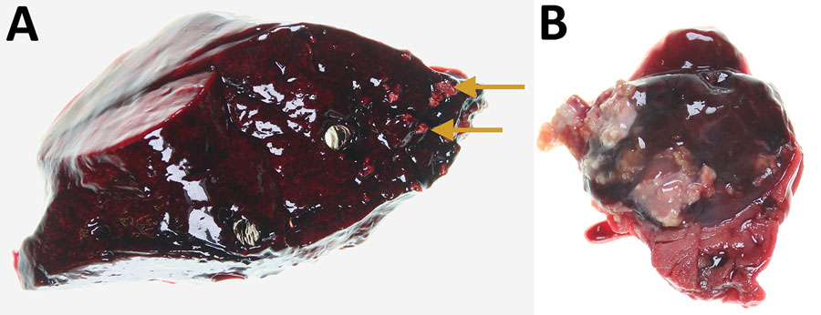 Lung and tracheobronchial lymph nodes from a wild mule deer (Odocoileus hemionus) infected with Mycobacterium avium spp. hominissuis, Banff National Park, Alberta, Canada. A) Mineralized granulomas in the right caudal lung lobe (arrows). B) Pyogranulomatous lymphadenitis of a tracheobronchial lymph node. The lesions resemble those caused by infection with M. bovis.
