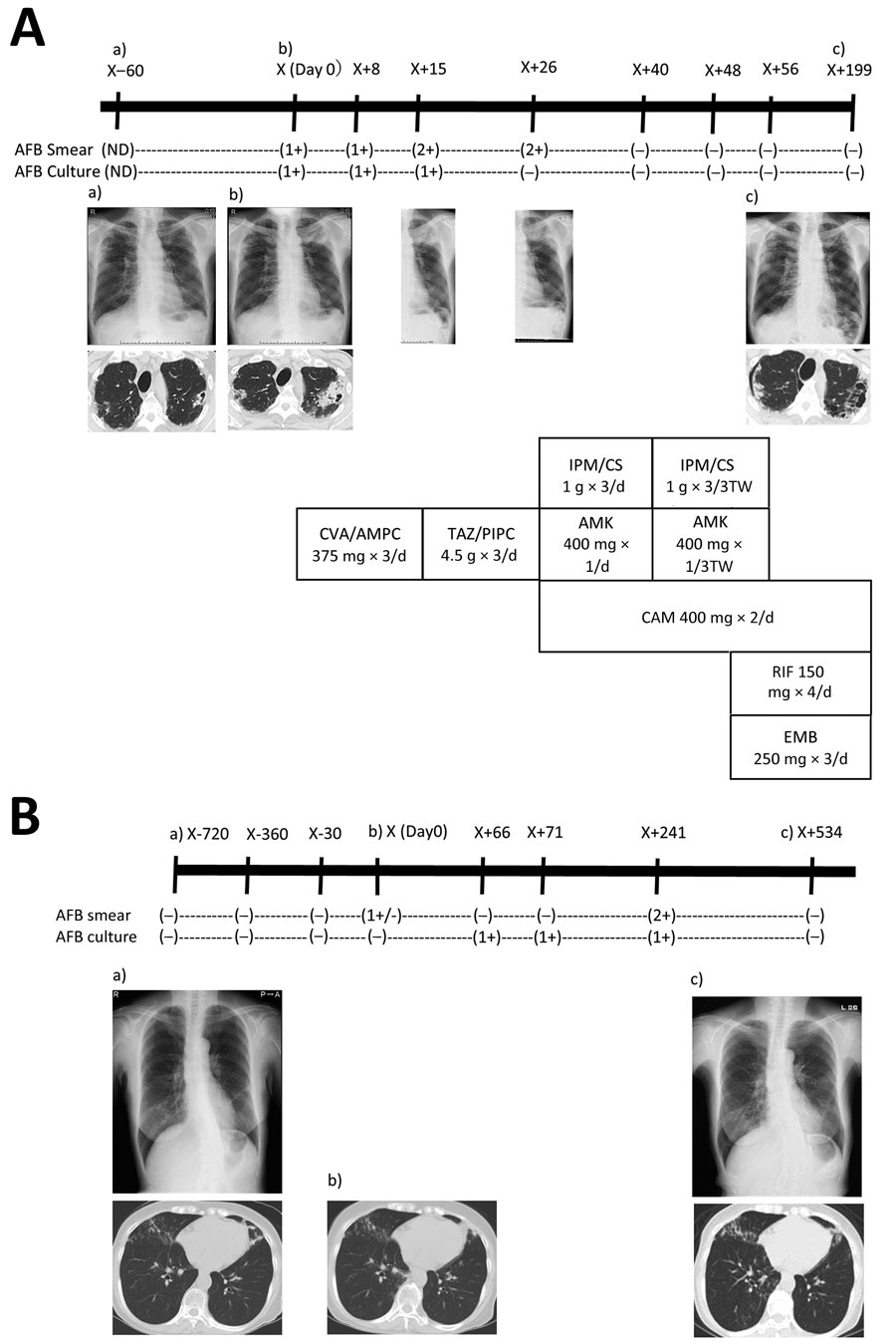 Radiographic and therapeutic drug monitoring for 2 patients with pulmonary disease caused by Mycobacterium shigaense. Each panel shows the timeline at the top (X, initial hospitalization period for M. shigaense disease) with smear results and chest radiograph (top) and chest CT (bottom) images below. The chemotherapy regimen is provided (Appendix). A) Case 1, patient with FC-type disease. a) Chest radiograph shows abnormal nodular shadows and a small calcification in the right upper and middle lung fields on day 60 before initial hospitalization. b) Chest radiograph taken 2 months later showed a more indistinct bilateral contour of the lung; there was increased consolidation of a cavitary lesion in the right upper lobe and a centrilobular nodule with branching in the left upper lobe on transverse chest CT. Lesions including progressive cavities are shown in the right upper and middle lung fields. c) Chest CT shows reduction in cavities and consolidation in the left lobe on day 199. B) Case 2, patient with NB-type disease. a) Chest CT showed a small nodular shadow in the right lower lung field. Image showed bronchiectasis in the left middle lobe and the lingular segment of the right upper lobe. There was peribronchiectasic consolidation and multiple small nodules suggesting bronchiolitis in both lungs. b) After 24 months, chest CT showed a stable extent of scattered small nodules including bronchiectasis just beneath the pleura and pleural thickening in the right middle lobe. c) Chest CT showed bronchiectasis in the right middle lobe. According to the number of AFB seen by Ziehl-Neelsen method for acid-fast staining, smear results were classified as 3+, 2+, 1+, or ±. –, negative; +, positive. AFB, acid-fast bacilli; AFB culture result –, culture negative; +, culture positive. AMK, amikacin; CAM, clarithromycin; CVA/AMPC, clavulanic acid/amoxicillin; CT, computed tomography; EMB, ethambutol; FC, fibrocavitary; IPM/CS, imipenem/cilastatin; NB, nodular bronchiectasis; ND, no data; RIF, rifampin; TAZ/PIPC, tazobactam/piperacillin.