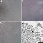 Thumbnail of Cytopathic effect caused by severe acute respiratory syndrome coronavirus 2 from patient with 2019 novel coronavirus disease, United States, 2020. A–C) Phase-contrast microscopy of Vero cell monolayers at 3 days postinoculation: A) Mock, B) nasopharyngeal specimen, C) oropharyngeal specimen. Original magnifications ×10). D) Electron microscopy of virus isolate showing extracellular spherical particles with cross-sections through the nucleocapsids (black dots). Arrow indicates a coro