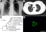 Thumbnail of Findings from a 51-year-old immunocompetent woman with a benign neoplasm and Cryptosporidium baileyi pulmonary infection, Poland, 2015. A) Chest radiography in posterior-anterior position. A tumor, 13 × 18 mm with well-defined boundaries, is visible in the third segment of the upper right lung (arrow). B) Patient’s lung tomogram. Tumor is visible in the right lung (arrow). C) Maximum log likelihood tree based on partial sequences of gene coding small subunit rRNA of Cryptosporidium,